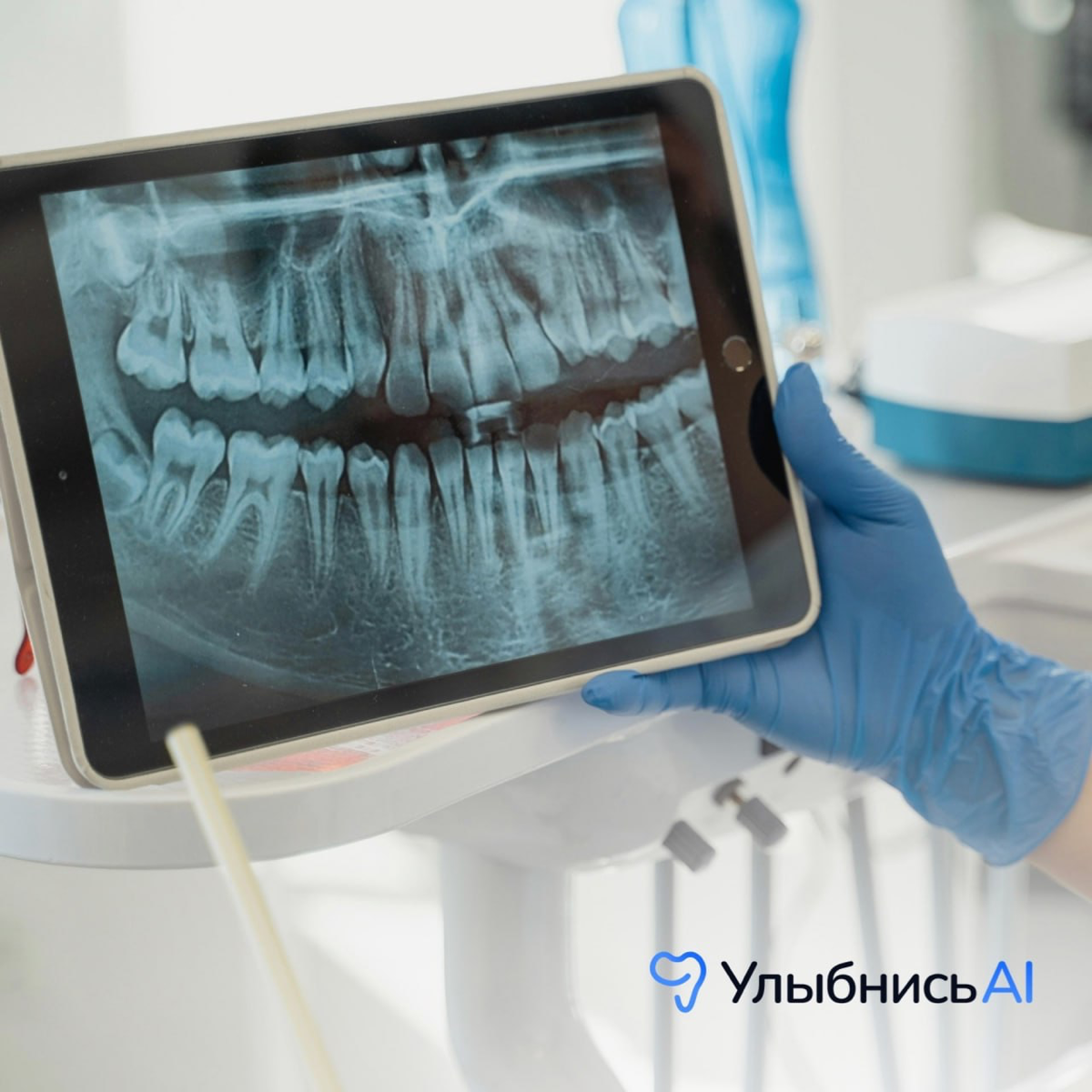 ⚡️«Улыбнись AI» — это телемедицинское приложение для удаленной первичной диагностики состояния здоровья зубов и дёсен | Сетка — социальная сеть от hh.ru