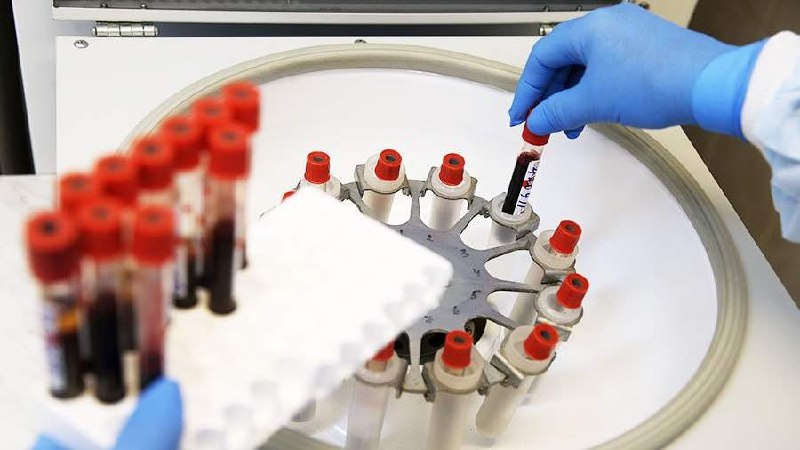 Американские ученые потенциально создали лекарство от ВИЧ — препарат на 100% защищает женщин от заражения. Если испытания на мужчинах будут столь же хороши, то болезнь уйдет в историю | Сетка — социальная сеть от hh.ru