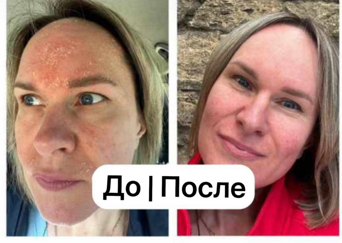 Комплексный подход к организму
Подтверждает качество нашей продукции
Более 25 лет на международном рынке | Сетка — социальная сеть от hh.ru