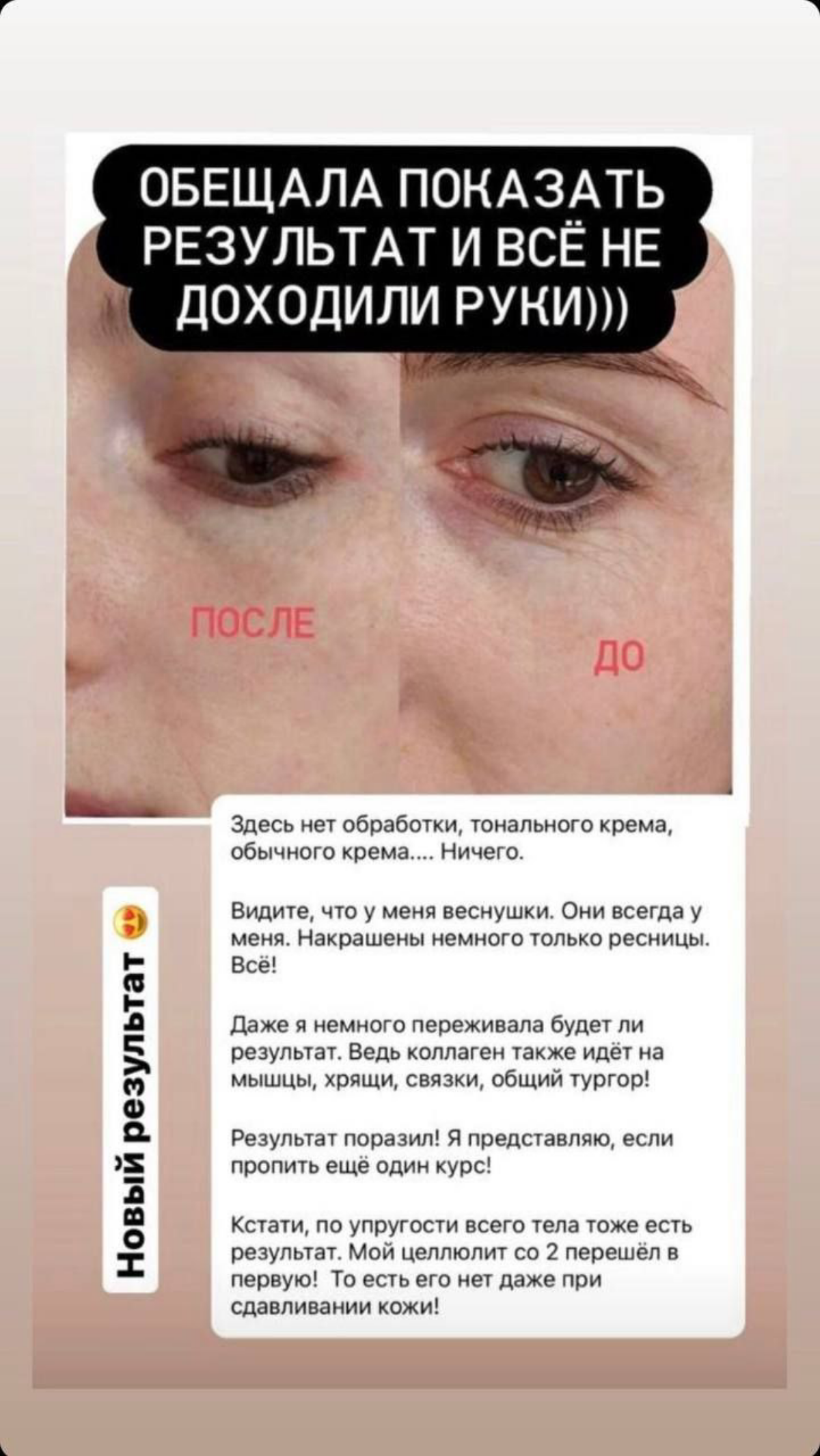 Комплексный подход к организму
Подтверждает качество нашей продукции
Более 25 лет на международном рынке | Сетка — социальная сеть от hh.ru