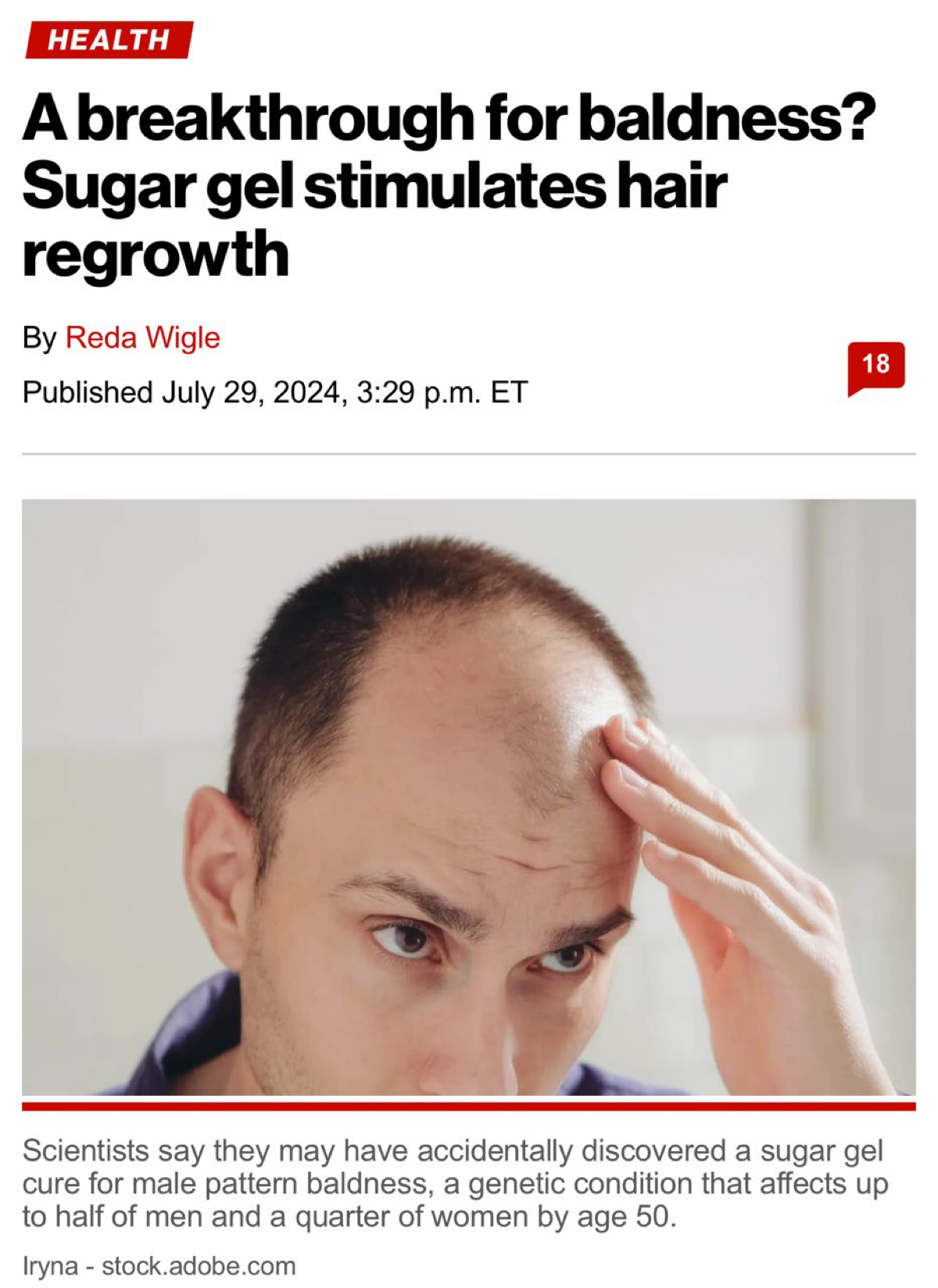 ⚡️ Ученые победили облысение! 
Учёные из Университета Шеффилда и Университета COMSATS в Пакистане случайно обнаружили, что сахарный сироп может стимулировать рост волос | Сетка — социальная сеть от hh.ru