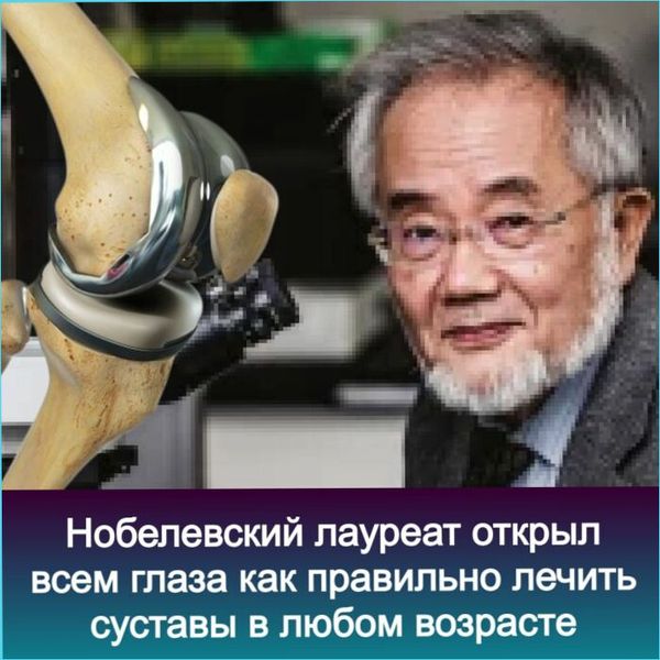🔤🔤🔤🔤
Привет всем! 🙌
Сегодня смотрю, всех не слабо подкосило 🫣 Как у вас? Удалось избежать встречи с рыжим демоном?
Тем временем я пробежался по спаю и отобрал самую жирную подборку активных крео — по ... | Сетка — социальная сеть от hh.ru