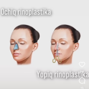 Зуха Хамраев