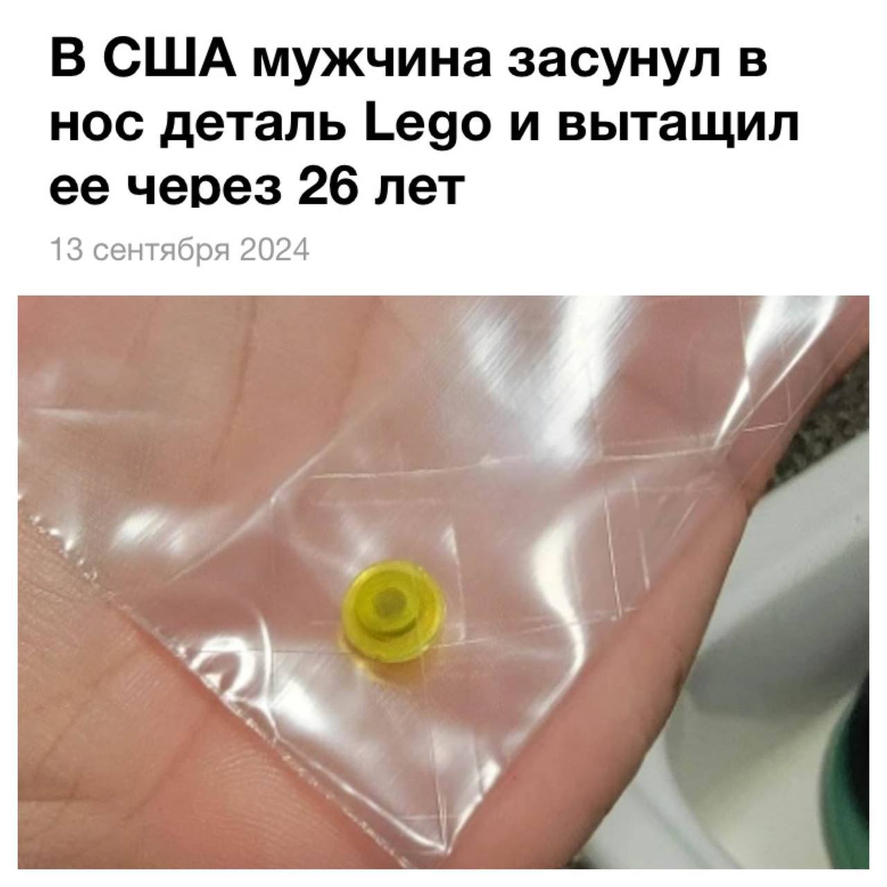 Мужик а США 25 лет страдал из-за проблем с дыханием — оказалось, у него в носу с 6 лет застряла деталька LEGO.
Слава Богу, я родился в России. В 5 лет засунул мигалку от модельки машины 🚨 в нос | Сетка — социальная сеть от hh.ru