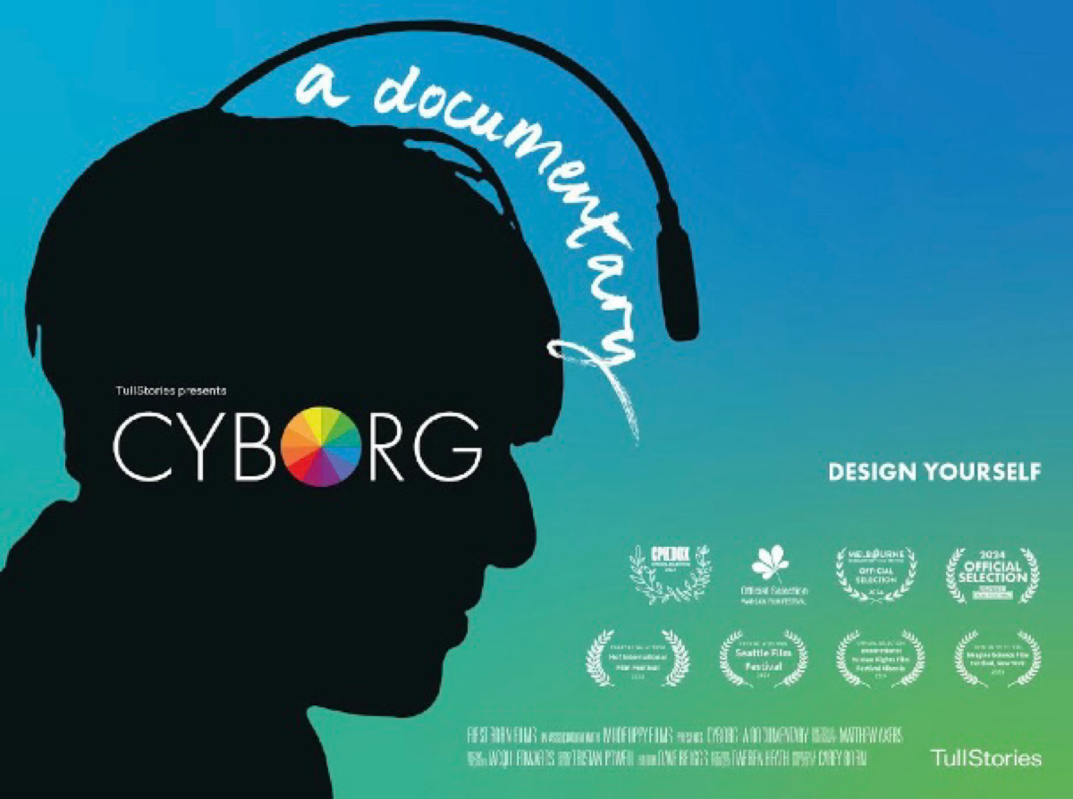 У художника Нила Харбиссона редкая врожденная аномалия зрения — ахроматопсия: полная цветовая слепота. Окружающий мир он видит черно-белым. Зато «слышит» цвета | Сетка — социальная сеть от hh.ru