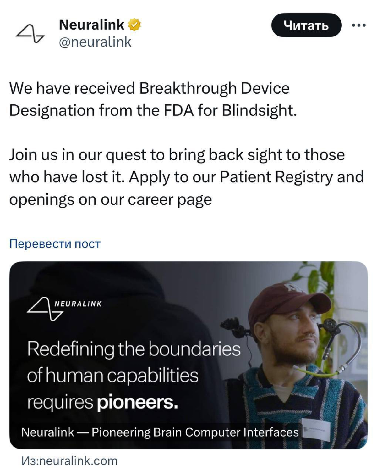 ⚡️Neuralink Илона Маска представила имплант Blindsight, который способен вернуть зрение даже тем, кто слеп от рождения | Сетка — социальная сеть от hh.ru