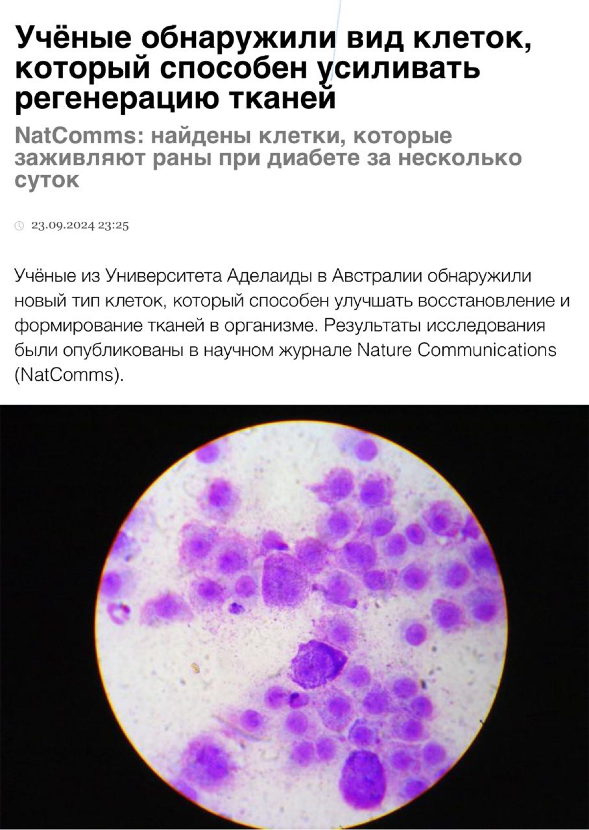 ⚡️EndoMac — это клетки-предшественники, которые способны улучшить восстановление и формирование тканей. Их обнаружили учёные из Университета Аделаиды в Австралии | Сетка — социальная сеть от hh.ru