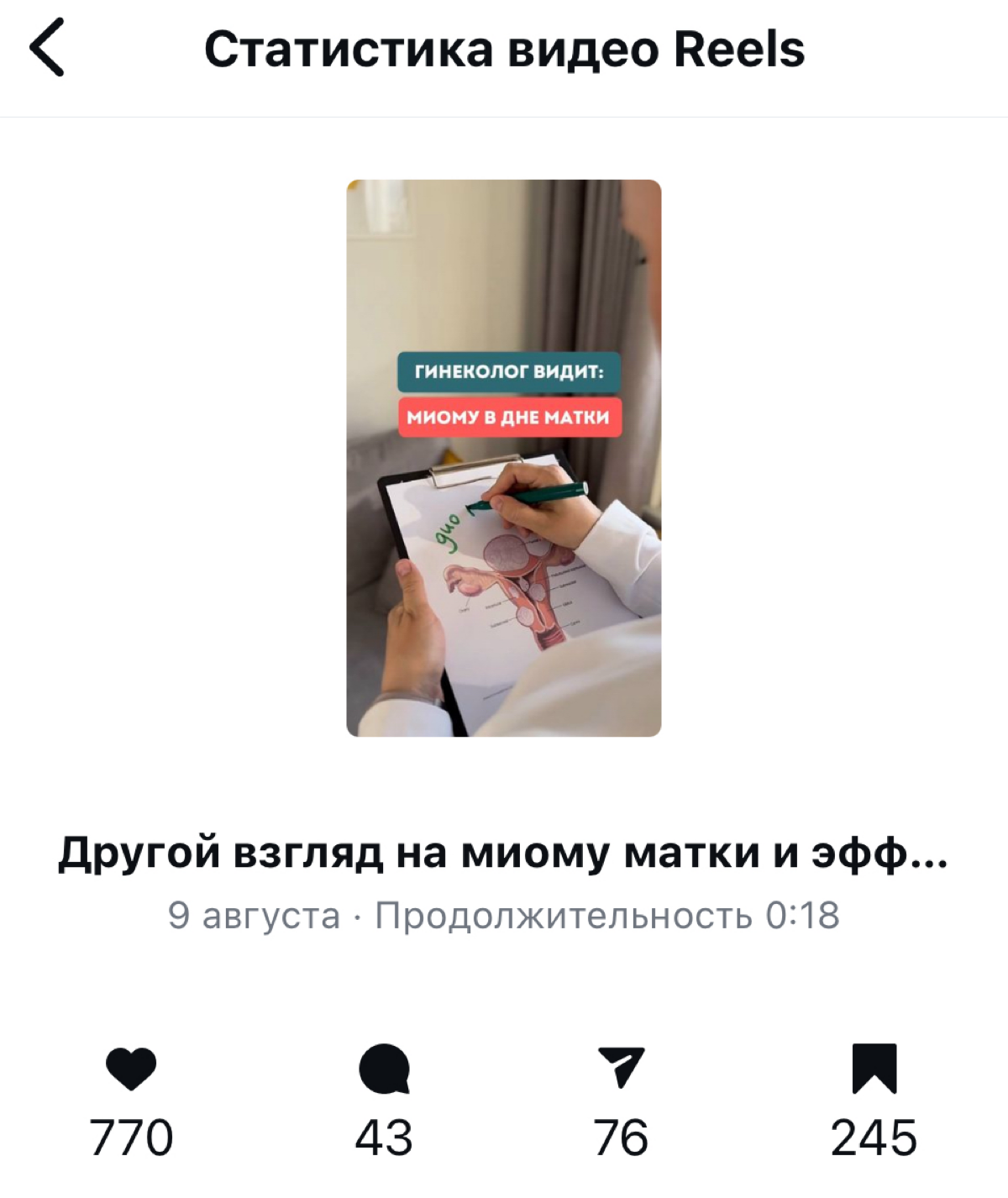 Я Алина рилсмейкер и сценарист рилс | Сетка — социальная сеть от hh.ru