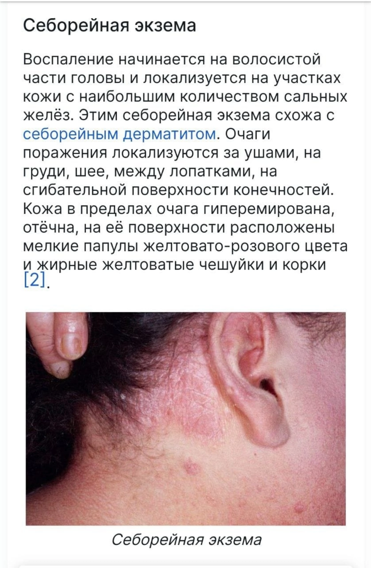 Крем «Гипполар»:
снимает болевые ощущения и зуд при аллергических высыпаниях;
способствует быстрой регенерации кожных покровов;
устраняет отечность и гиперемию;
уничтожает бактерии, вирусы и грибки;
в... | Сетка — социальная сеть от hh.ru