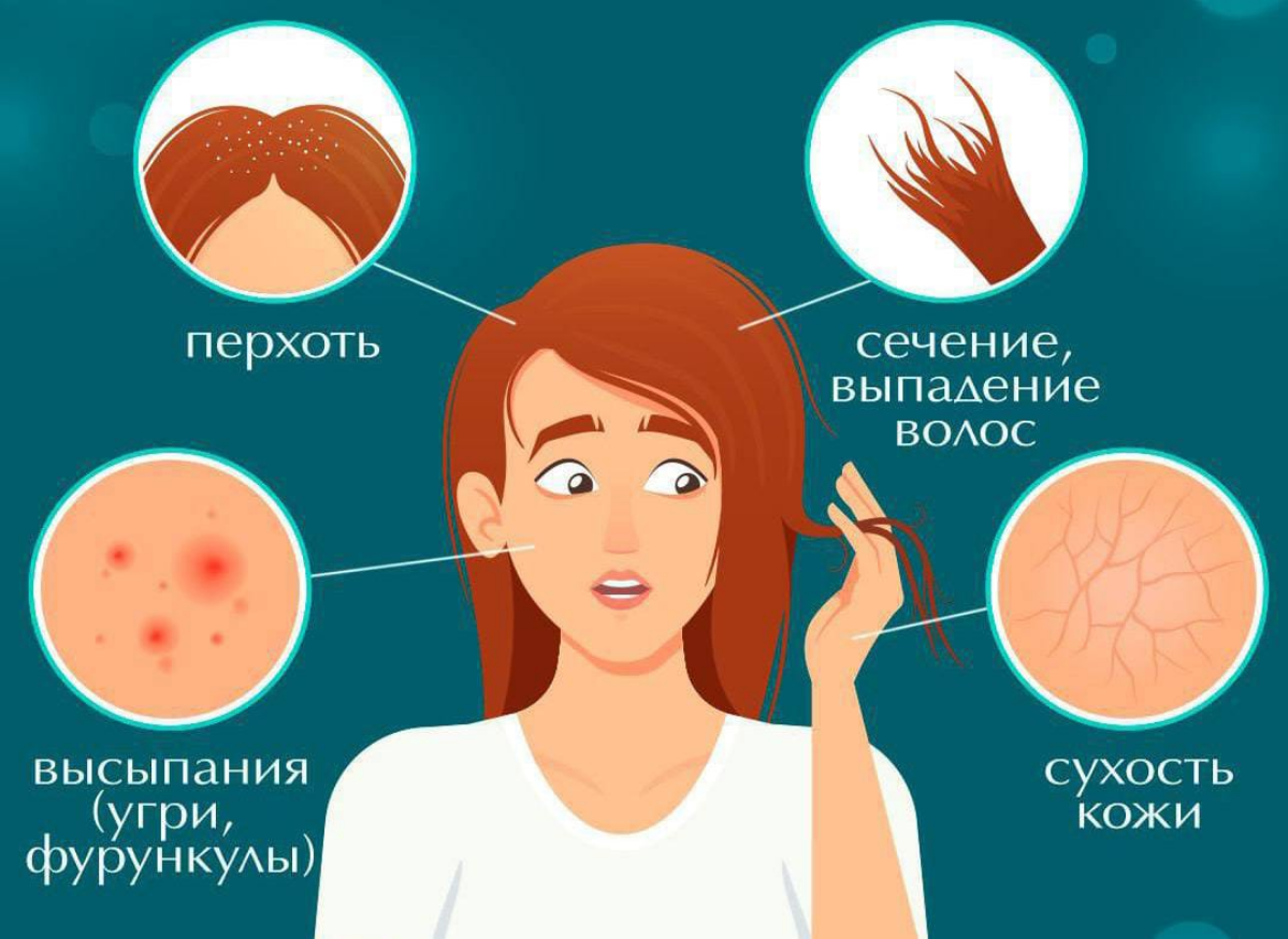 Коллаген для волос, кожи и ногтей: В чем секрет?
Коллаген — это важнейший белок, который поддерживает здоровье нашей кожи, волос и ногтей. Он действует как «каркас», удерживающий клетки и ткани вместе | Сетка — социальная сеть от hh.ru