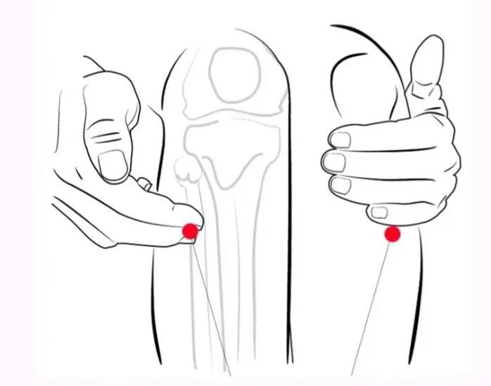 Точка Цзу-Сань-Ли (или Zu San Li, 足三里) — это одна из наиболее известных акупунктурных точек в традиционной китайской медицине | Сетка — социальная сеть от hh.ru