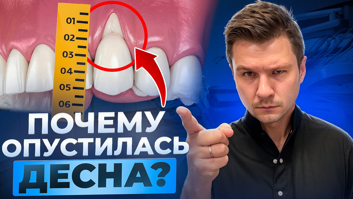 ❓ Почему одно видео набирает просмотры, а другое нет? Как работают алгоритмы YouTube?
🔸 После отключения таргетированной рекламы на просторах YouTube, единственным источником привлечения новой аудитор... | Сетка — социальная сеть от hh.ru