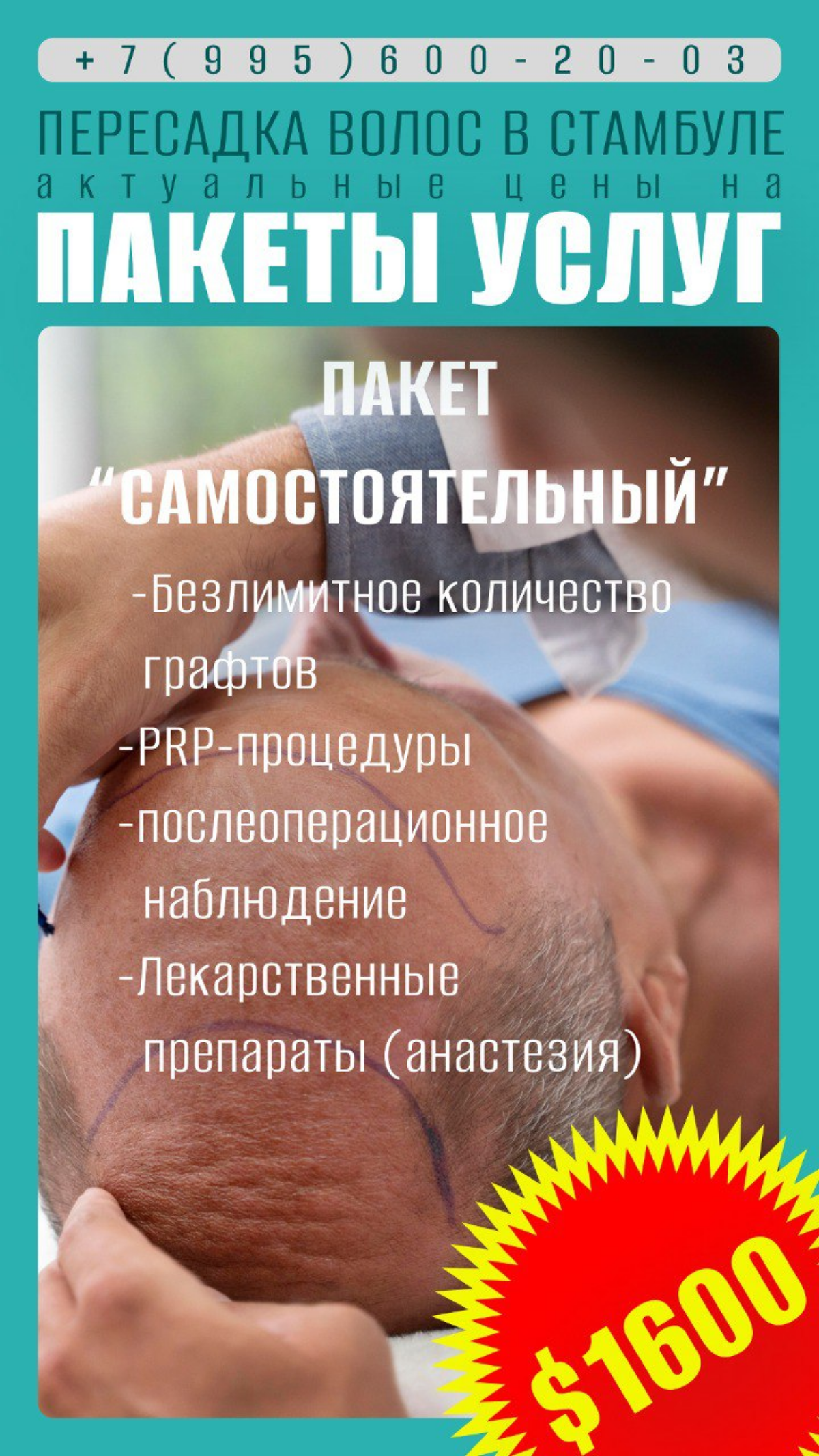 Небольшой гайд по ценам на пересадку волос в Стамбуле. | Сетка — социальная сеть от hh.ru