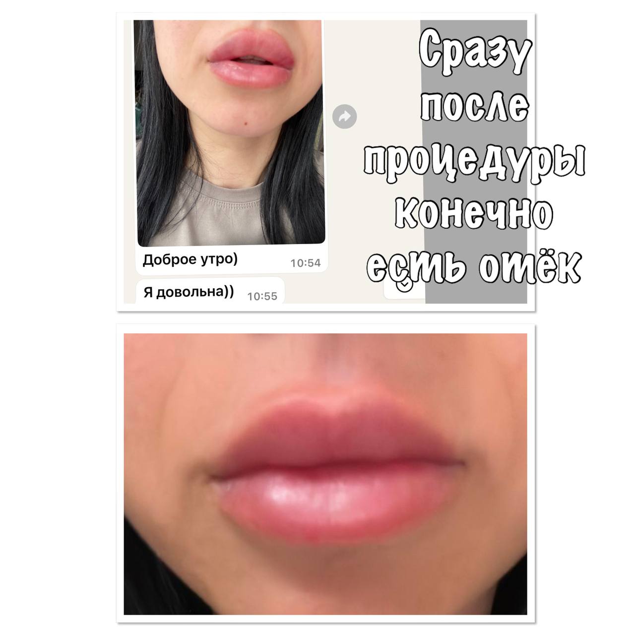 А кто-то хочет вот так,💋
Скажете не естественно?
Да, такая коррекция не может остаться незаметной, но человеку комфортно именно с такими губами, и это её право 😉 | Сетка — социальная сеть от hh.ru