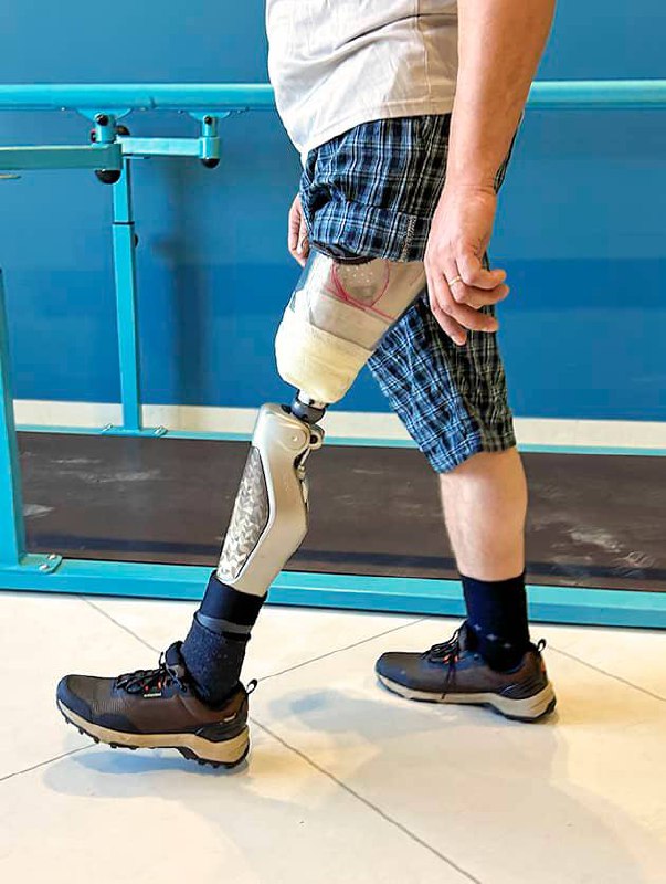 Февраль астрологи провозгласили месяцем спецвыпуска про дизайн в медицине, а конкретно в протезировании 🦾🦿
Но, перед тем, как кинуться в пучины исторического контекста и красивых картинок, предлагаю о... | Сетка — социальная сеть от hh.ru