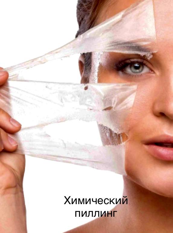 Сезон пилингов ещё продолжается
Поэтому сегодня обсудим эту замечательную процедуру и воздействие кислот на вашу кожу 😉 | Сетка — социальная сеть от hh.ru