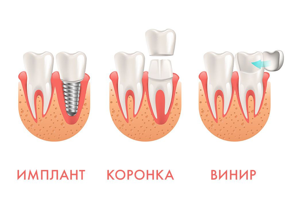 Обычно, когда мы говорим о протезах, в первую очередь думают о чем-то крупном, например руках или ногах
Но вообще протезы бывают самые разные, в том числе разных частей лица (например части челюсти ил... | Сетка — социальная сеть от hh.ru