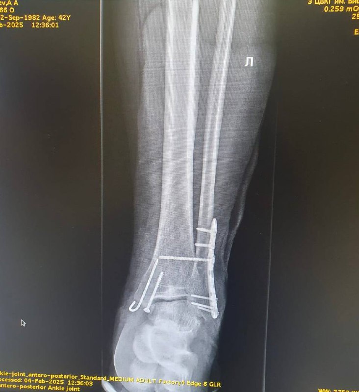 Мы со старшей дочкой периодически ходим попрыгать на батуты 🤸‍♂️. На последних двух занятиях мы решили взять персонального тренера, чтобы отточить навыки в выполнении сальто вперед и назад | Сетка — социальная сеть от hh.ru