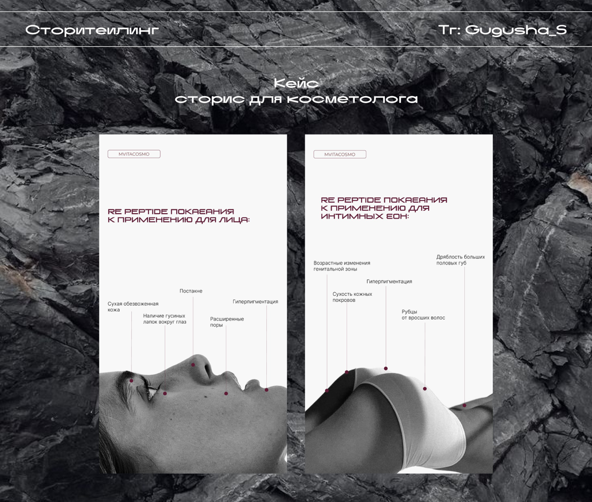 Разработка дизайна сторис для косметолога💻
Срок выполнения - 2 дня.
Меня зовут Гульнара, я веб-дизайнер | Сетка — социальная сеть от hh.ru