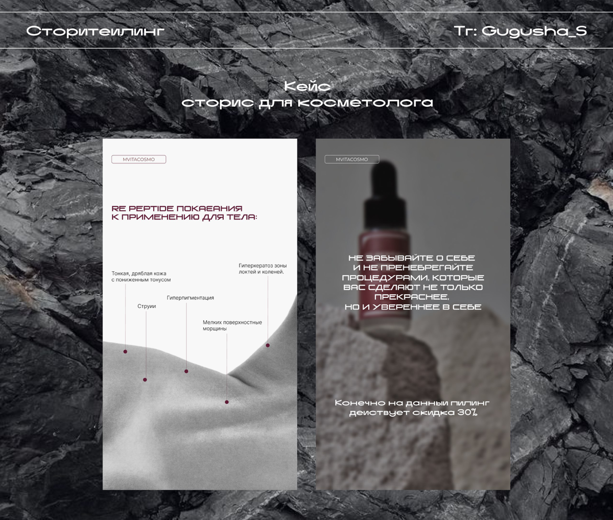 Разработка дизайна сторис для косметолога💻
Срок выполнения - 2 дня.
Меня зовут Гульнара, я веб-дизайнер | Сетка — социальная сеть от hh.ru