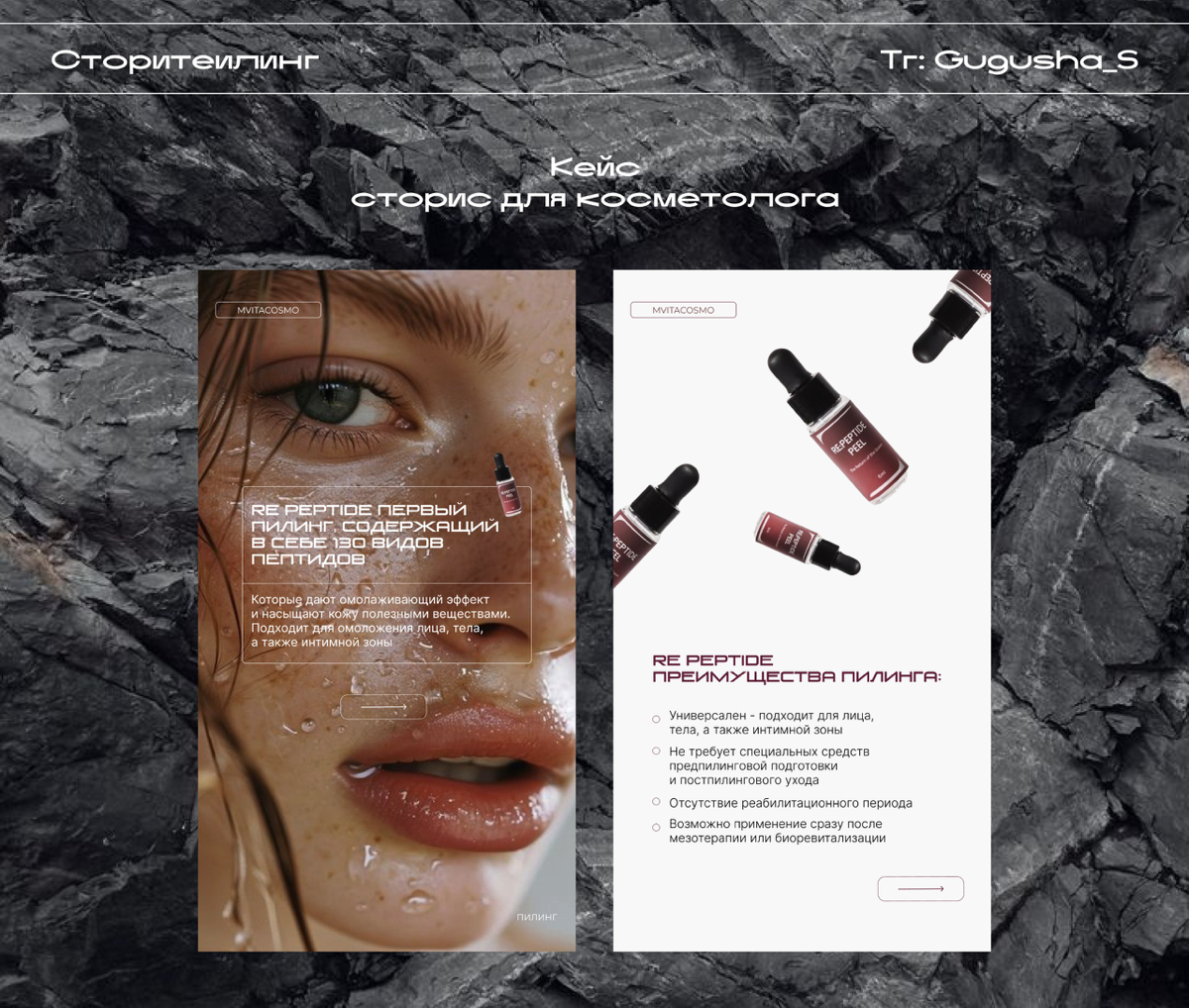 Разработка дизайна сторис для косметолога💻
Срок выполнения - 2 дня.
Меня зовут Гульнара, я веб-дизайнер | Сетка — социальная сеть от hh.ru