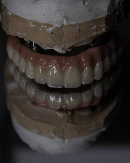 Профессиональное 3D-моделирование зубов | CAD/CAM
Предлагаю услуги по 3D-моделированию зубов для стоматологических клиник, зуботехнических лабораторий и частных специалистов | Сетка — социальная сеть от hh.ru