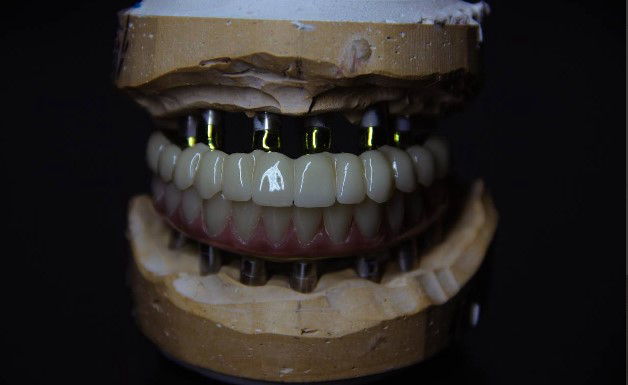 Профессиональное 3D-моделирование зубов | CAD/CAM
Предлагаю услуги по 3D-моделированию зубов для стоматологических клиник, зуботехнических лабораторий и частных специалистов | Сетка — социальная сеть от hh.ru