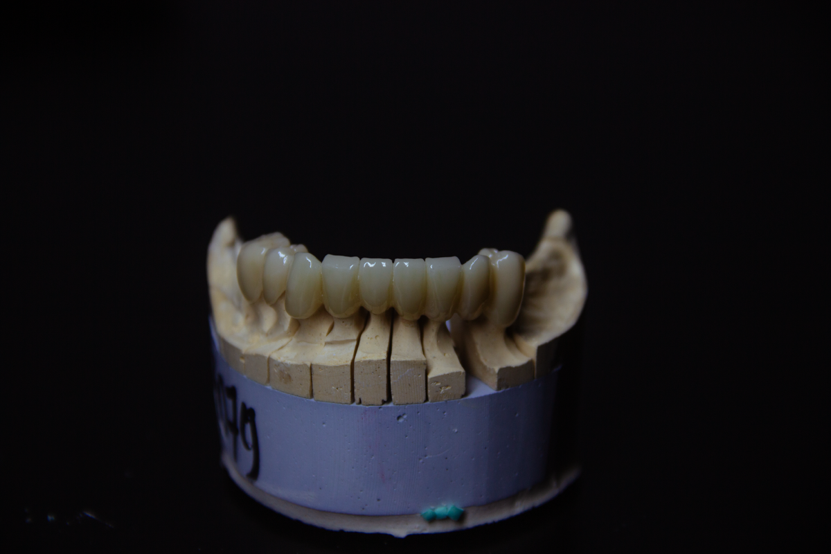 Профессиональное 3D-моделирование зубов | CAD/CAM
Предлагаю услуги по 3D-моделированию зубов для стоматологических клиник, зуботехнических лабораторий и частных специалистов | Сетка — социальная сеть от hh.ru