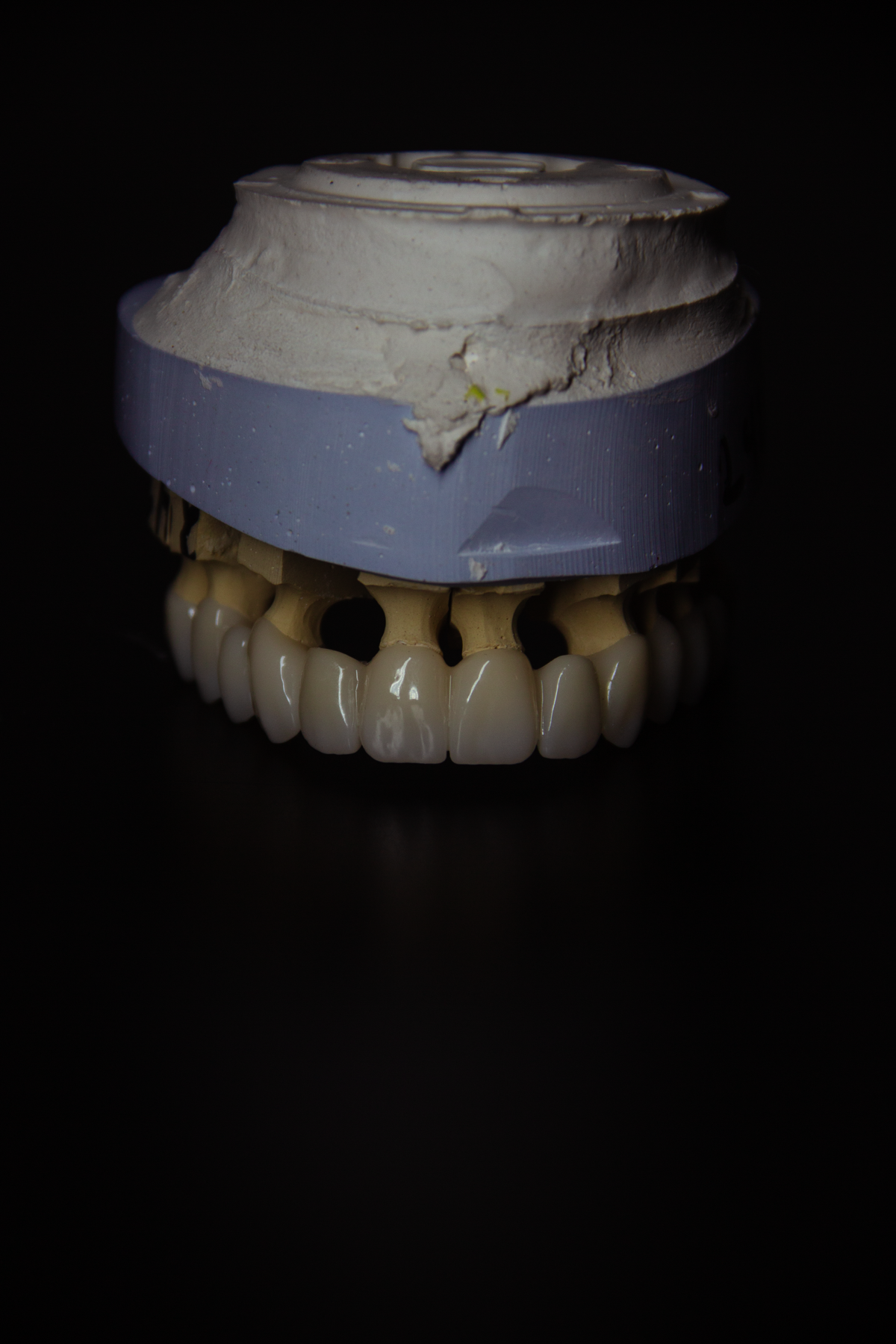 Профессиональное 3D-моделирование зубов | CAD/CAM
Предлагаю услуги по 3D-моделированию зубов для стоматологических клиник, зуботехнических лабораторий и частных специалистов | Сетка — социальная сеть от hh.ru