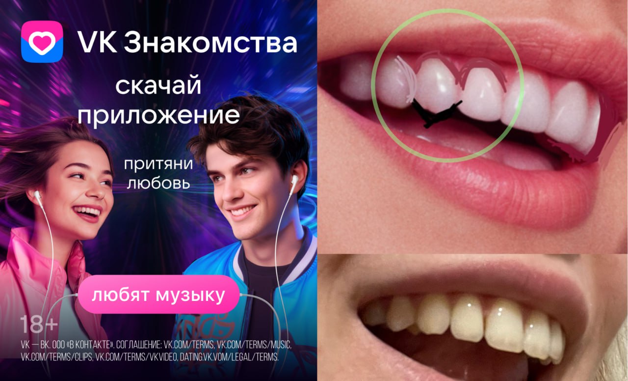 Написала мини-статью о нюансах нейросетевой ретуши — на примере проекта VK Знакомств.
Читаем/изучаем по 👉ссылке | Сетка — социальная сеть от hh.ru