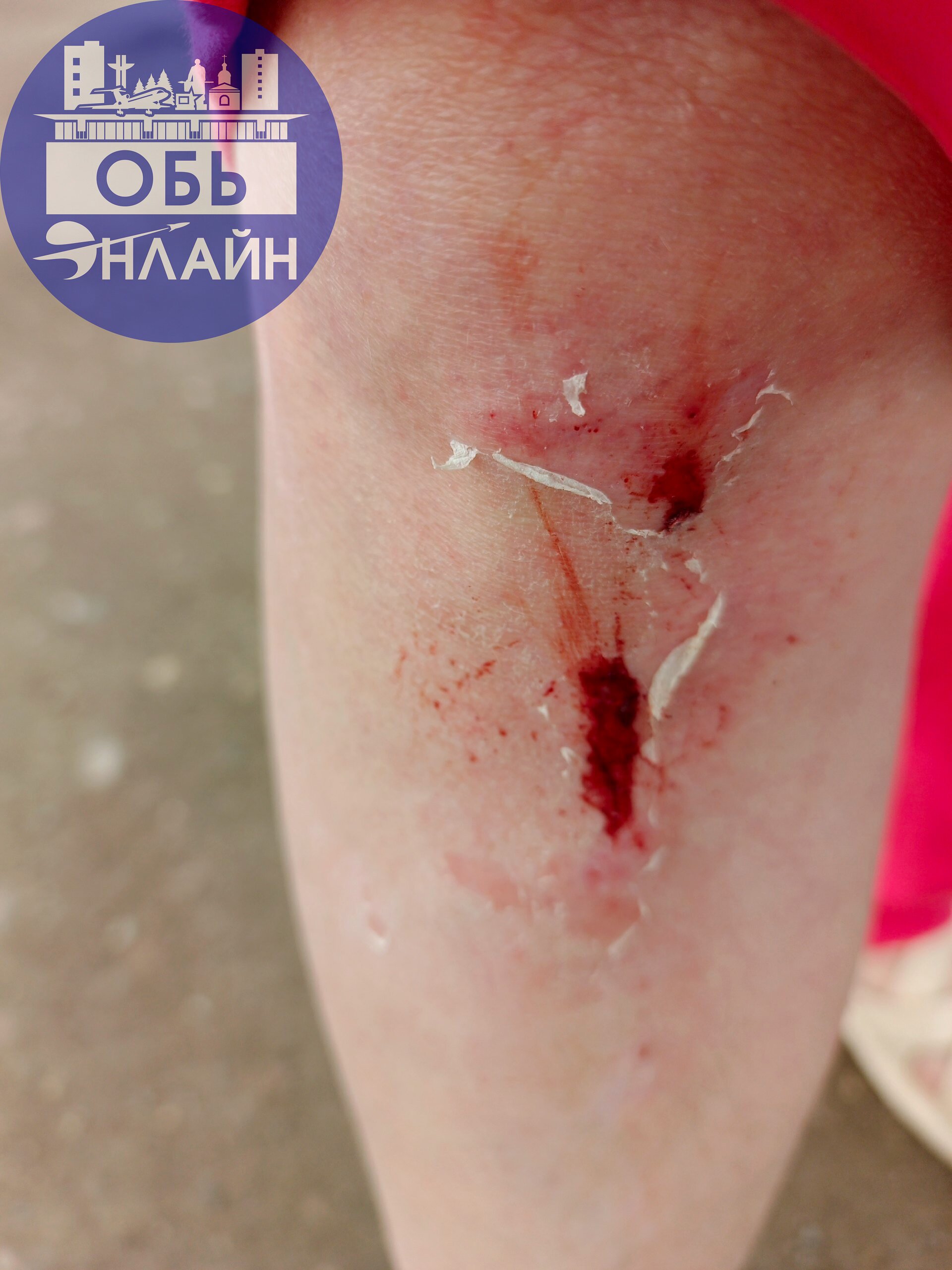 ↗ Подскажите пожалуйста, куда можно обратиться?!?!
Сегодня шла с детьми по данной лестнице, фото прилагаю | Сетка — социальная сеть от hh.ru