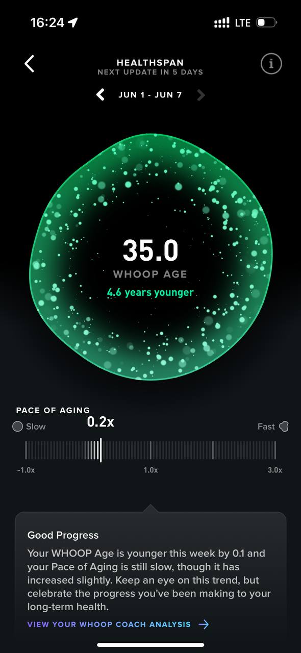 Не успел я толком походить с Whoop 4.0, как вышла 5-я версия, да ещё и в 3 вариантах. Пришлось обновляться | Сетка — социальная сеть от hh.ru