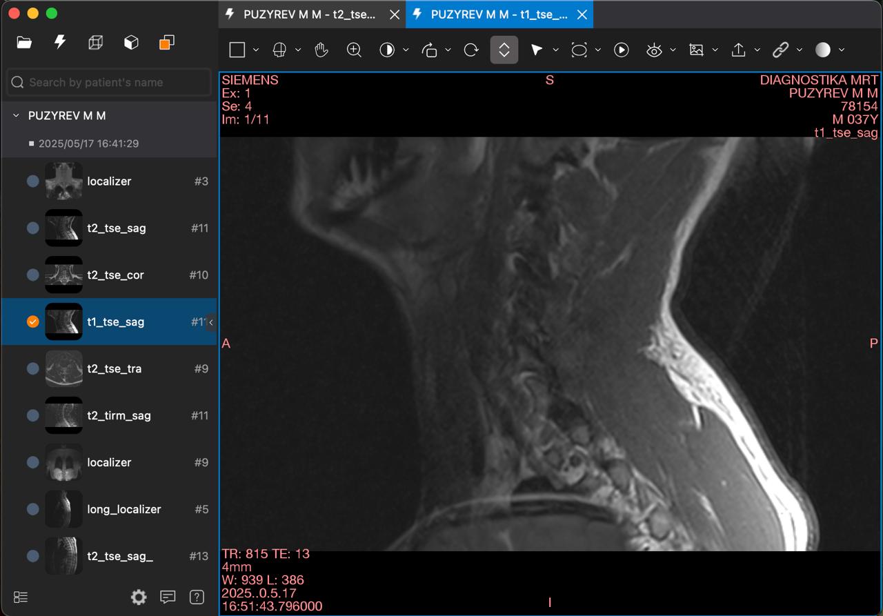 Как получить доступ к своим МРТ-снимкам: Простое решение для каждого
Привет! Думаю, многие из вас, кто проходил МРТ, задавались вопросом:
"Как врачи видят эти сложные снимки, а я нет?" | Сетка — социальная сеть от hh.ru