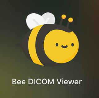 Как получить доступ к своим МРТ-снимкам: Простое решение для каждого
Привет! Думаю, многие из вас, кто проходил МРТ, задавались вопросом:
"Как врачи видят эти сложные снимки, а я нет?" | Сетка — социальная сеть от hh.ru
