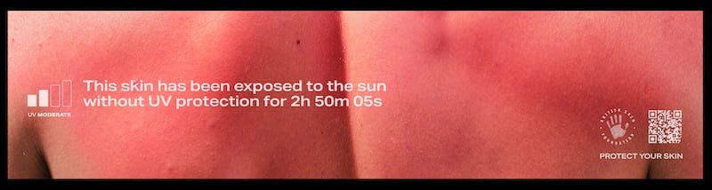 British Skin Foundation запустила кампанию #TheBurnableBillboard («Обгорающий билборд») | Сетка — социальная сеть от hh.ru