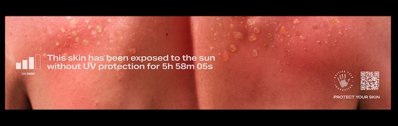 British Skin Foundation запустила кампанию #TheBurnableBillboard («Обгорающий билборд») | Сетка — социальная сеть от hh.ru
