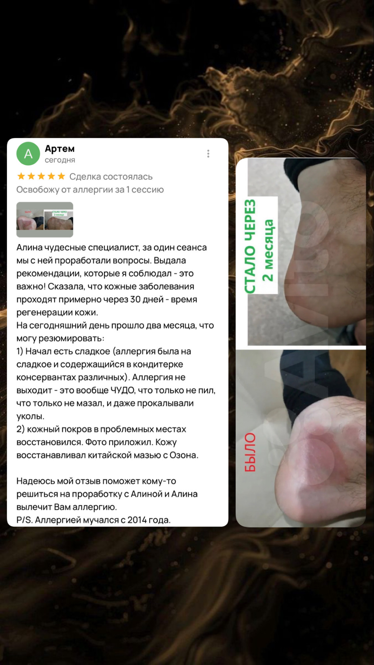 7 слайдов как формируется АЛЛЕРГИЯ | Сетка — социальная сеть от hh.ru
