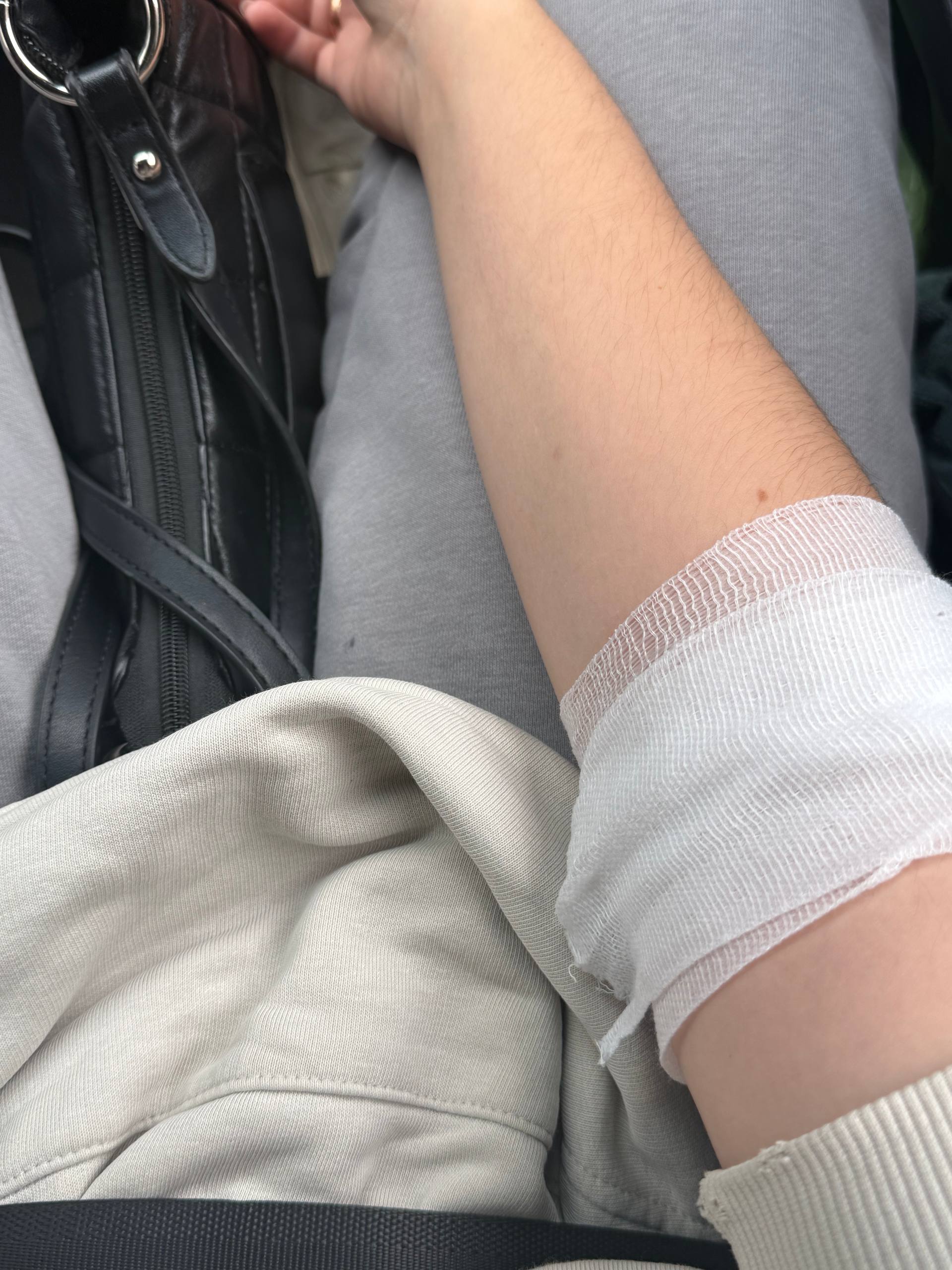 Вчера была на неприятной процедуре, которую не помню, потому что делала ее под седацией 😅 Мне первый раз делали наркоз, меня бесконтрольно трясло, от чего мы посмеялись с врачами, а через секунду я ус... | Сетка — социальная сеть от hh.ru