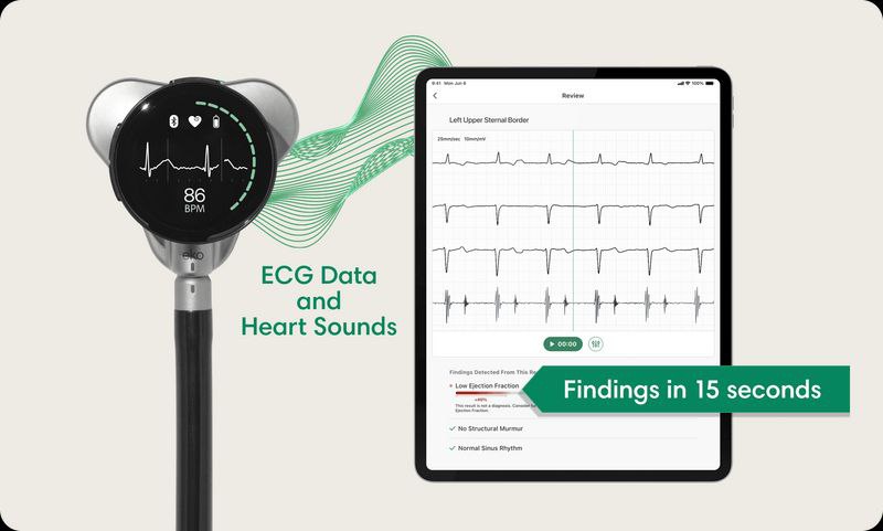 🧠 AI News | Здоровье сердца и ИИ
Знакомьтесь с будущим кардиодиагностики: умный стетоскоп, который за 15 секунд ставит предварительный диагноз | Сетка — социальная сеть от hh.ru