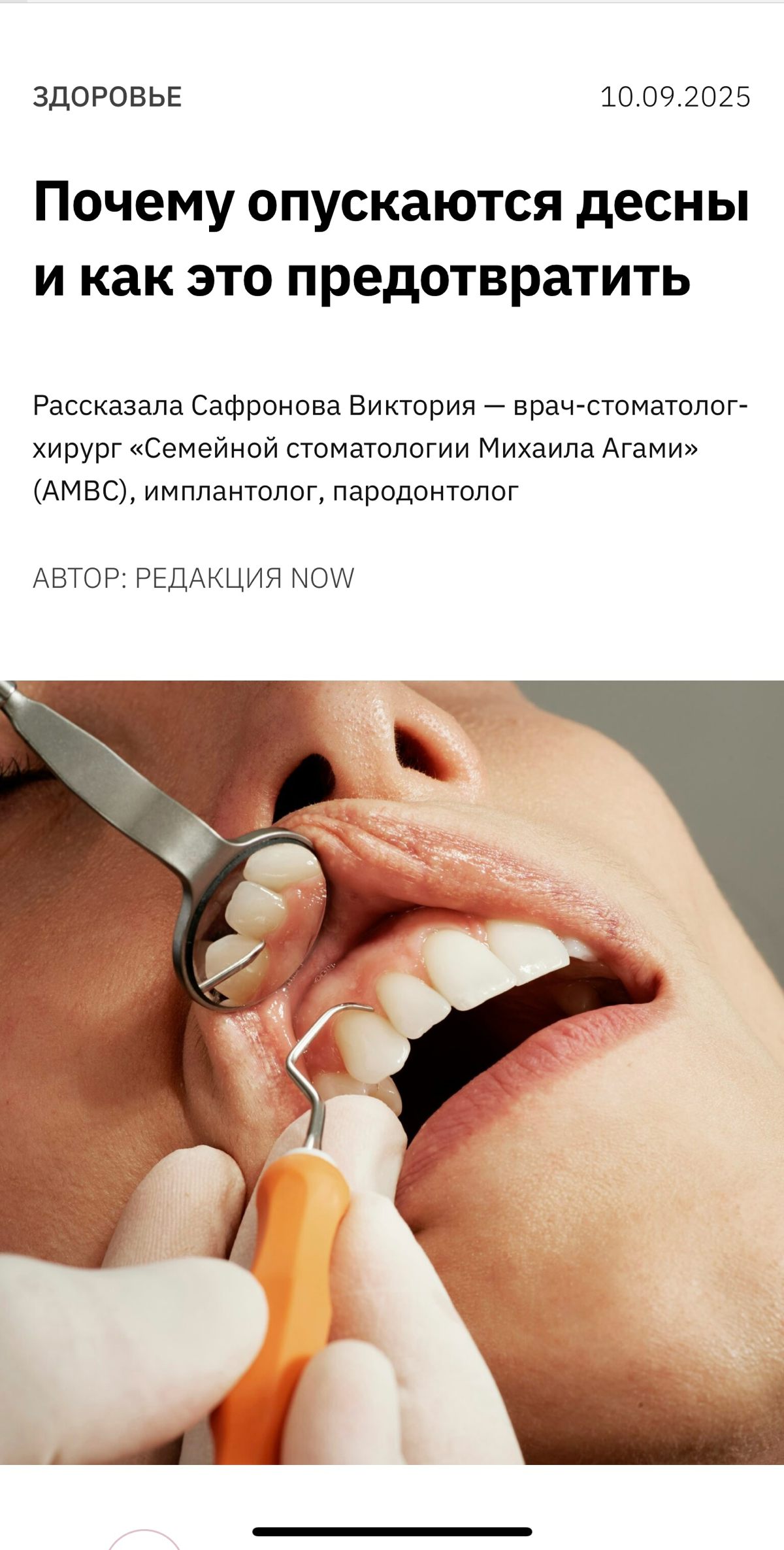 Вышла моя статья о причинах и способах лечения рецессии десны.
https://nownownow.ru/women/health-women/pochemu-opuskayutsya-desny-i-kak-eto-predotvratit/ | Сетка — социальная сеть от hh.ru
