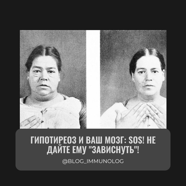 🤯 Гипотиреоз и ваш мозг: SOS! Не дайте ему "зависнуть"! 🤯
Сколько раз вы ловили себя на мысли:

🚪 Вошли в комнату и забыли, зачем?
🗓 Забыли важную дату, и тетя обиделась на пропущенный день рождения? ... | Сетка — социальная сеть от hh.ru