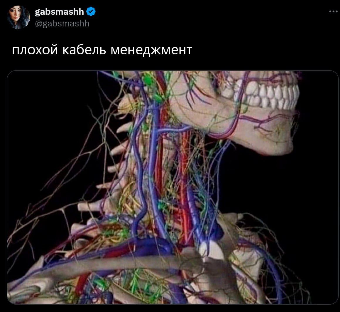 Все наши беды из-за плохого кабель менеджмента)))) | Сетка — социальная сеть от hh.ru