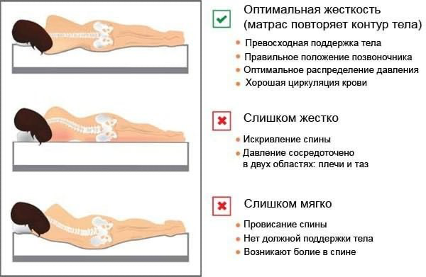 Хорошая осанка: ортопедическая поддержка сновидений | Сетка — социальная сеть от hh.ru