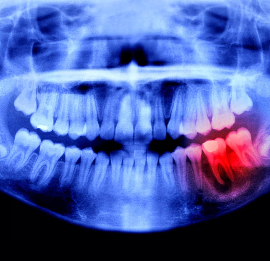 🔥 РЕВОЛЮЦИЯ В СТОМАТОЛОГИИ! ЯПОНЦЫ УЧАТ НАС ВЫРАЩИВАТЬ НОВЫЕ ЗУБЫ! 🔥
Представьте: никаких имплантов, никаких мостов, никаких съемных протезов | Сетка — социальная сеть от hh.ru