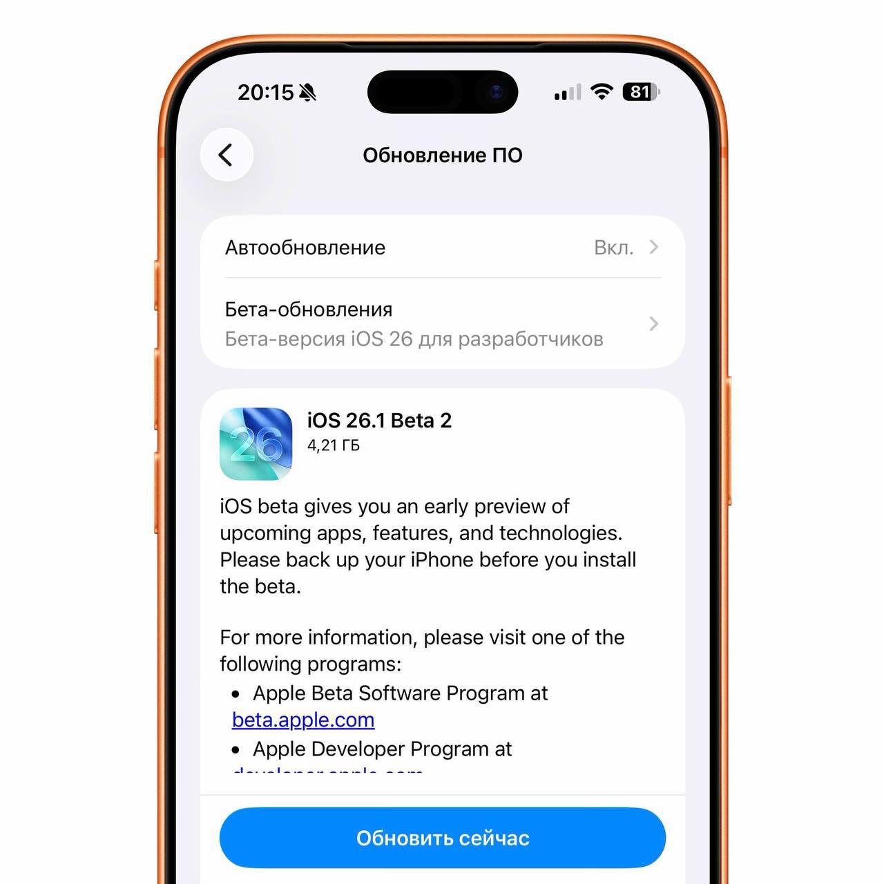 🍏 Стала доступна iOS 26.1 Beta 2 для разработчиков
• Вероятно, крупных обновлений нет, Apple скорее закроет уязвимости. | Сетка — социальная сеть от hh.ru