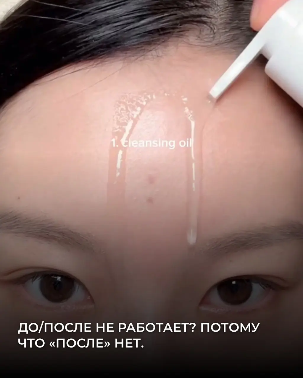 До/после не работает? Потому что “после” нет.
Кейс: SKIN1004 (1004 Centella)
Бренд SKIN1004 не придумывал UGC-стратегию. Он просто сделал продукт, от которого люди реально в шоке | Сетка — социальная сеть от hh.ru
