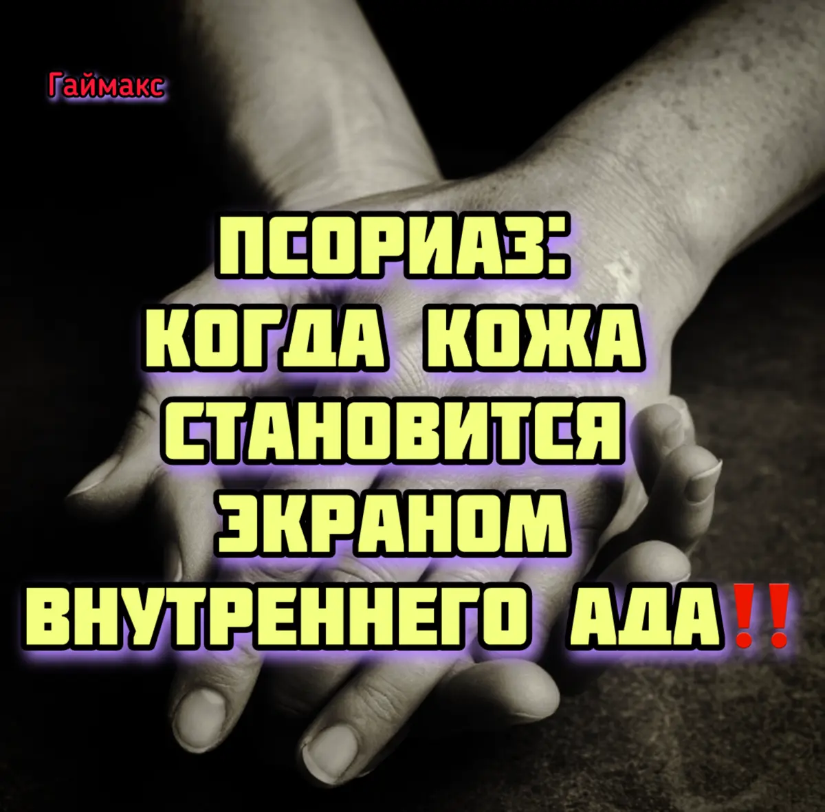 Псориаз: Когда кожа становится экраном внутреннего ада‼️ | Сетка — социальная сеть от hh.ru