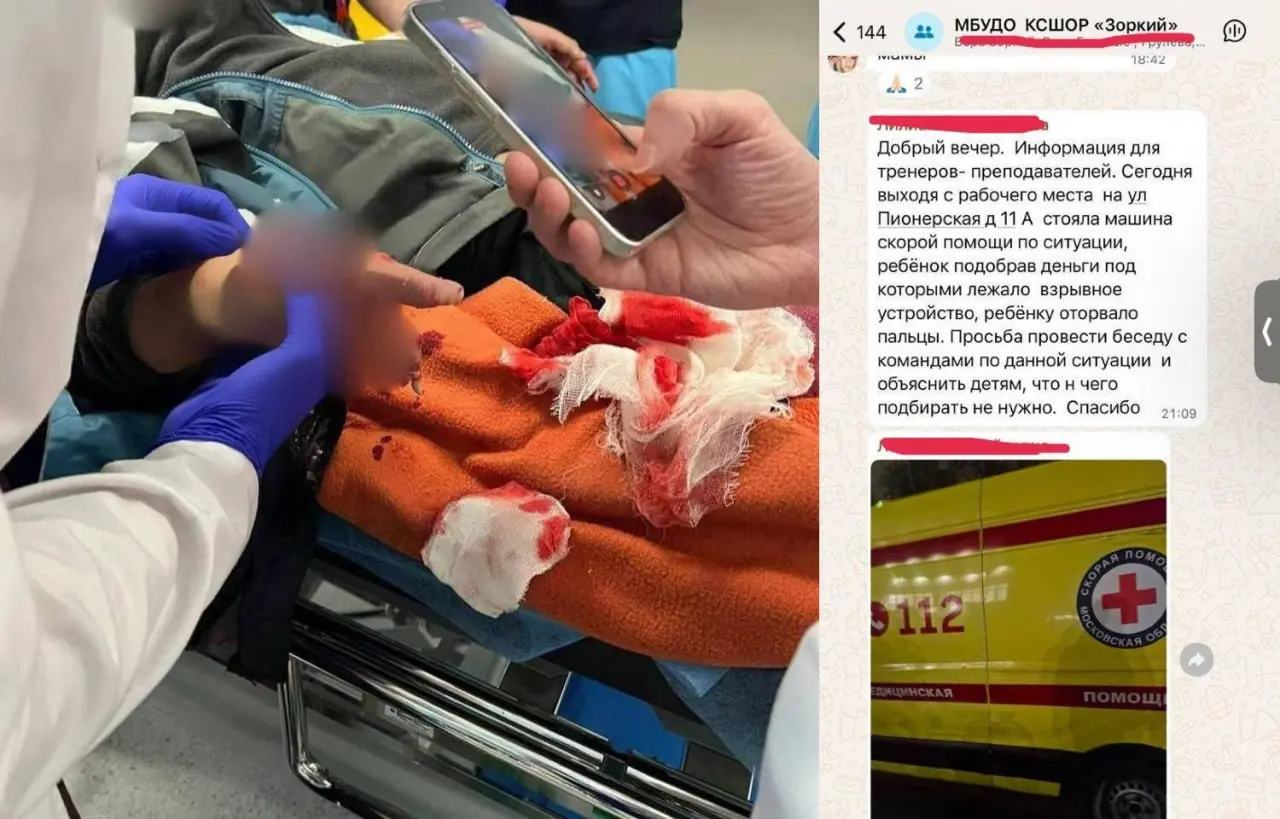 😱Ребенку разорвало кисть в Красногорске, после того как он поднял с земли деньги. Инцидент произошел на детской площадке | Сетка — социальная сеть от hh.ru