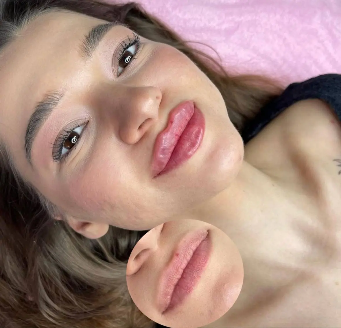 Какие же вы у меня красивые 😍
Восхищаюсь
Контурная пластика губ 1,1ml
Запись 🗓
📞Тел: 89179772607
What’sApp/ telegram
С любовью ваш косметолог ❤️
#мезосамара #косметолог #нити #косметологсамара #красот... | Сетка — социальная сеть от hh.ru