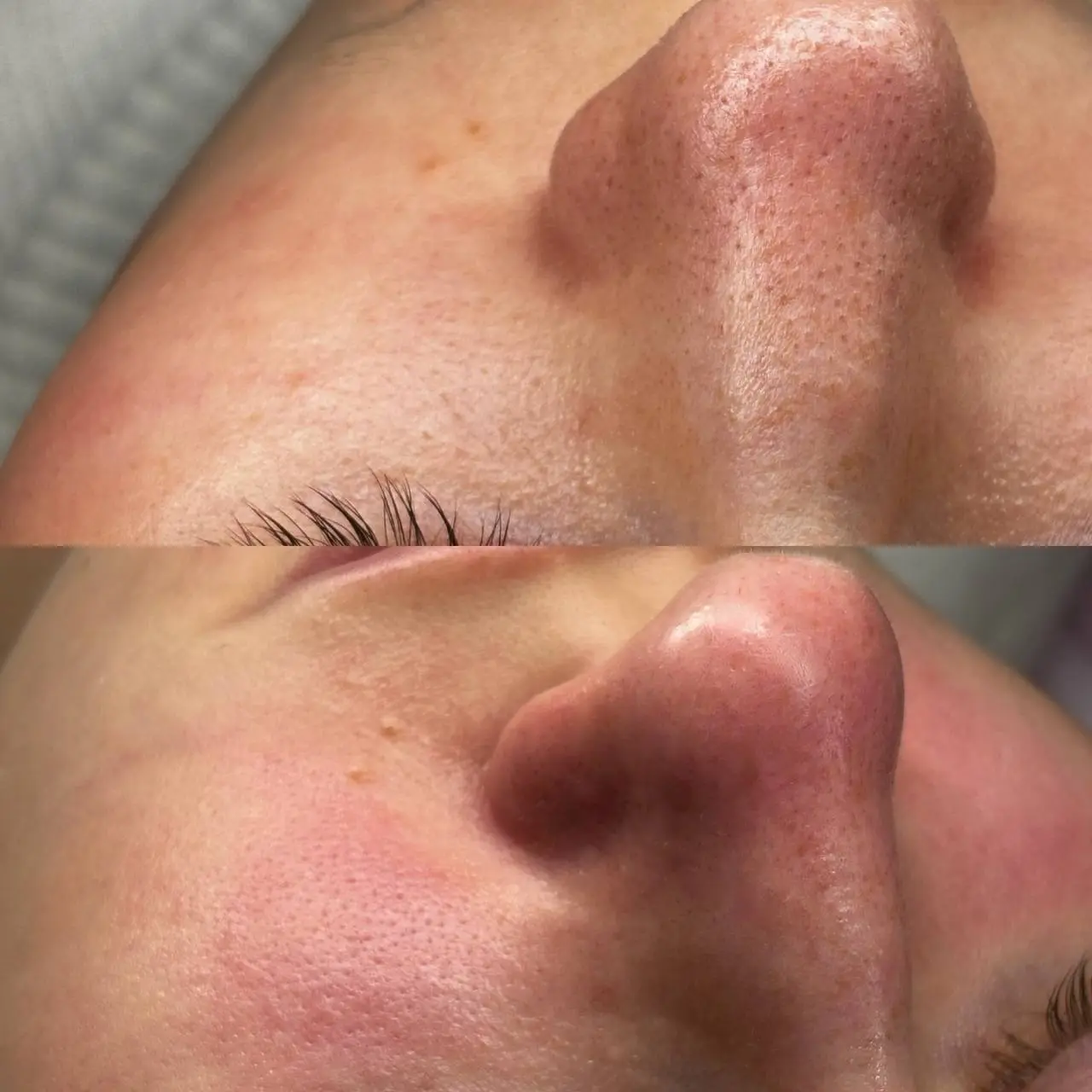 Базовый минимум 🤌
Запись 🗓
📞Тел: 89179772607
What’sApp/ telegram
С любовью ваш косметолог ❤️
#мезосамара #косметолог #нити #косметологсамара #красота #губы #контурнаяпластика #контурнаяпластикагуб #ин... | Сетка — социальная сеть от hh.ru